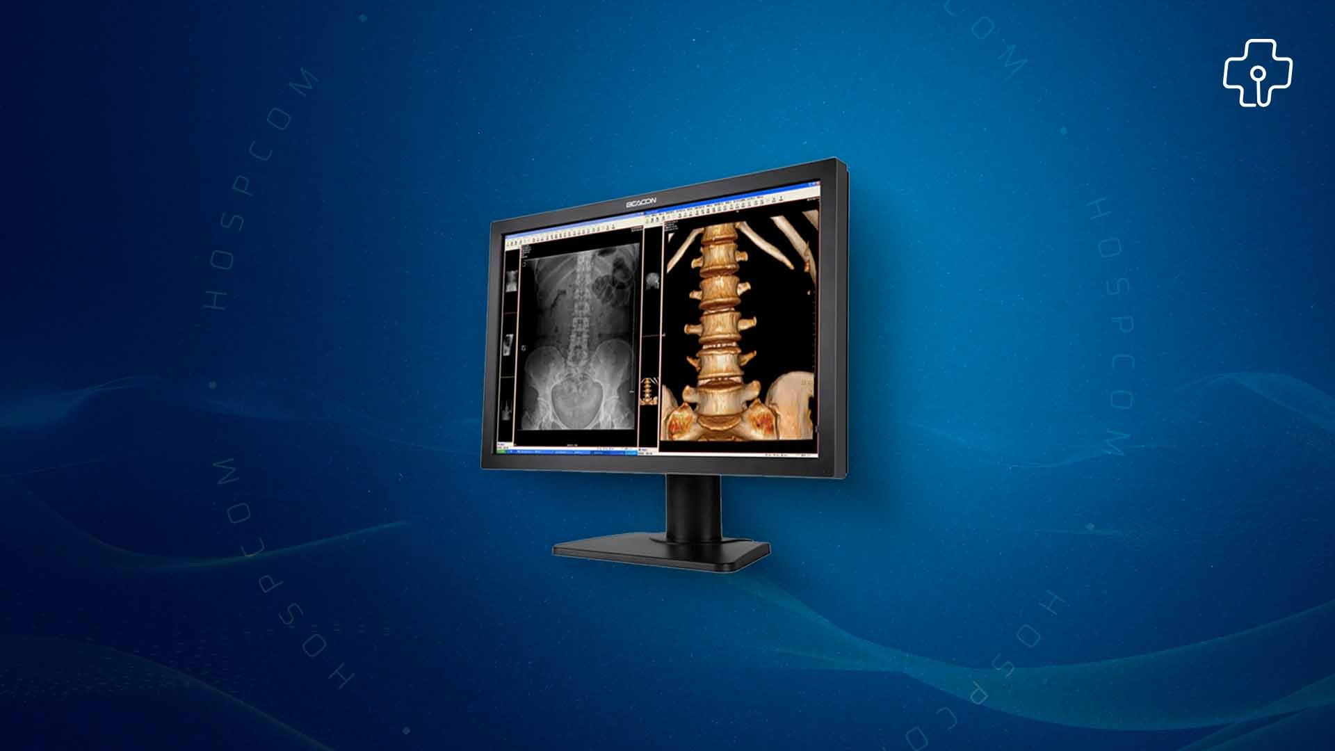 Beacon: Monitores Hospitalares especializados